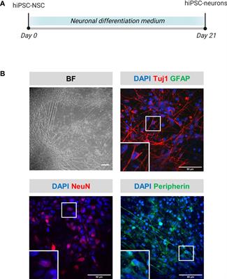 Lack of strong innate immune reactivity renders macrophages alone unable to control productive Varicella-Zoster Virus infection in an isogenic human iPSC-derived neuronal co-culture model